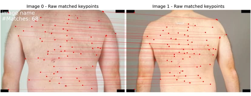 Tracking Skin Changes Over Time