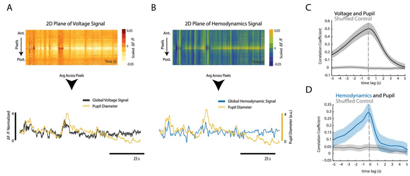 Neural Correlates of Attention and Decision Making